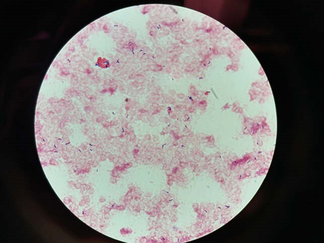 graphic file with name 1-f624.jpg