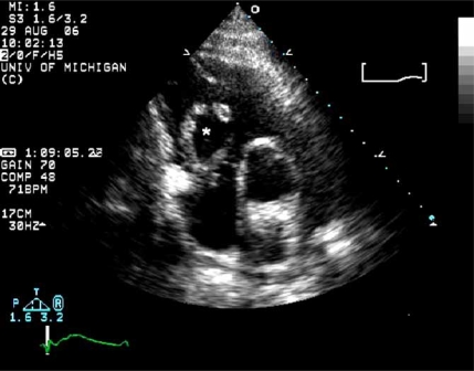 Fig. (5)