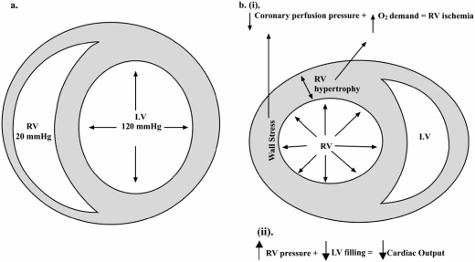 Fig. (1)