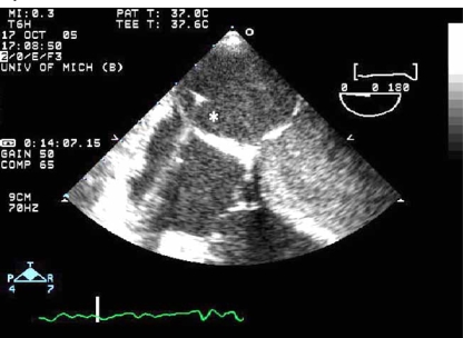 Fig. (4)