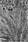 493
