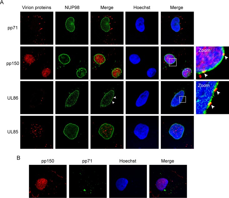 FIG 14