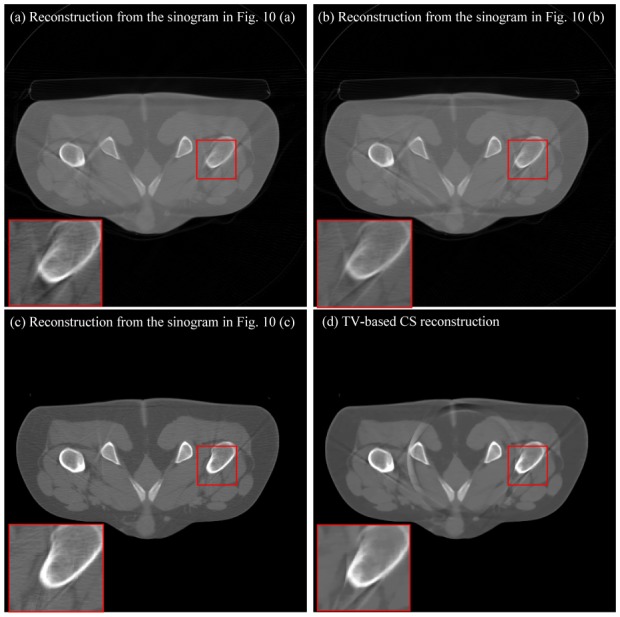 Fig. 11