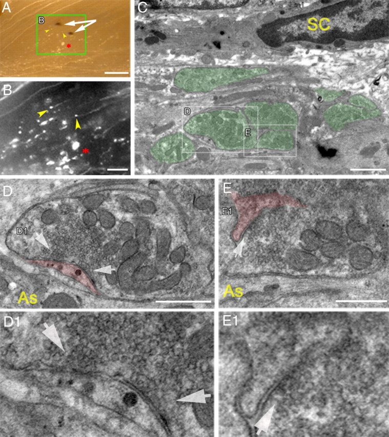 Figure 11.