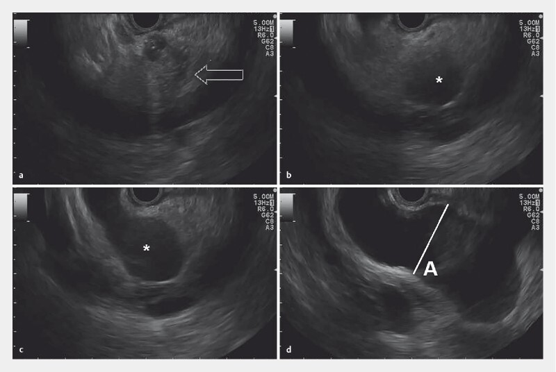 Fig. 1