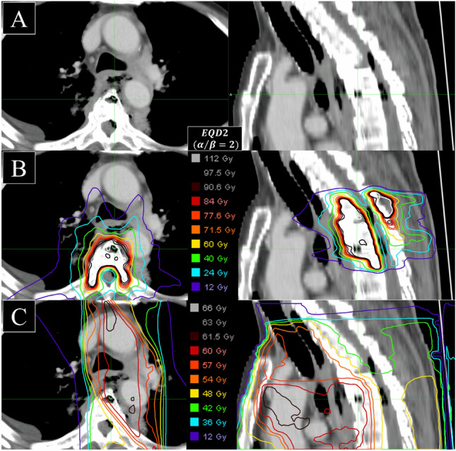 Fig. 3