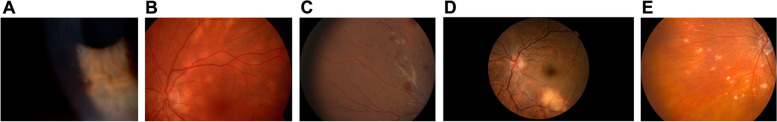 Fig. 1