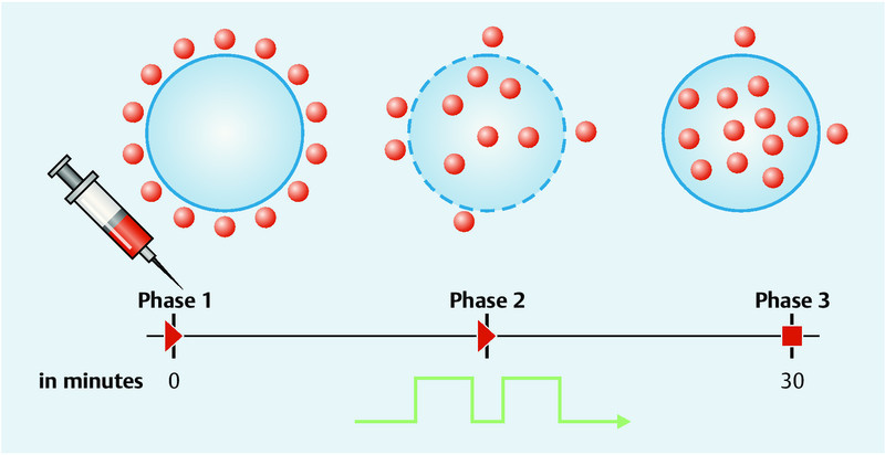 Fig. 1