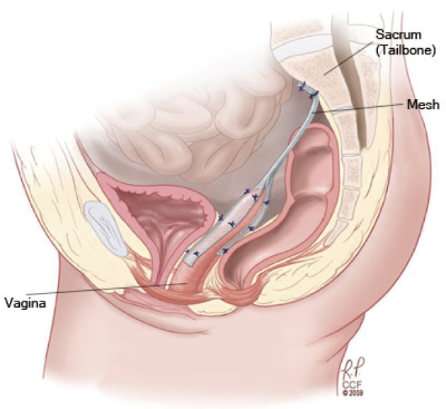 Figure 5.