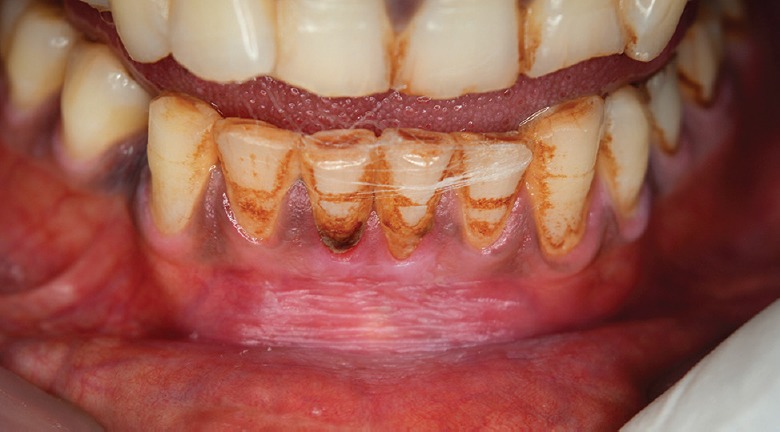Fig. 8