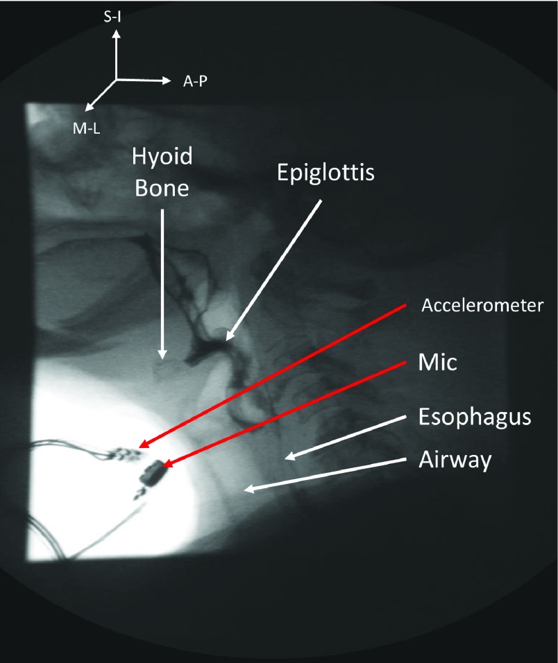 FIGURE 1.