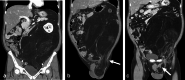 Fig. 1