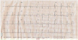 [Table/Fig-1e]: