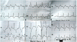 [Table/Fig-1c]: