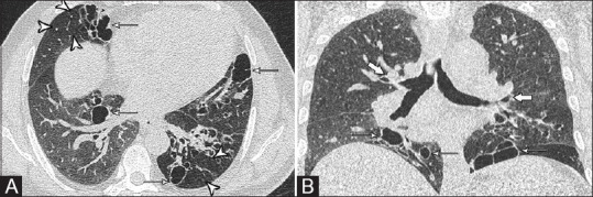 Figure 4 (A and B)