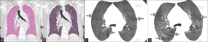 Figure 2 (A-D)