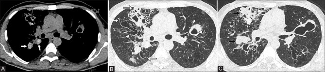 Figure 3 (A-C)