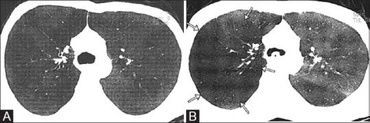 Figure 5 (A and B)