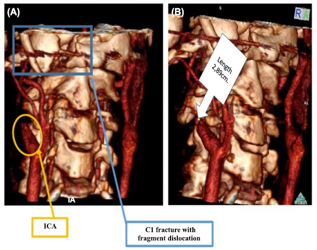 Fig. (3)