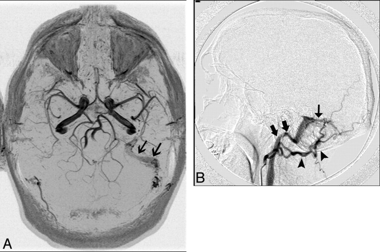 Fig 12.