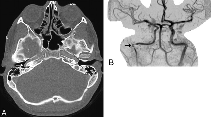 Fig 2.