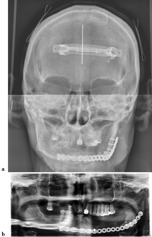 Fig. 10