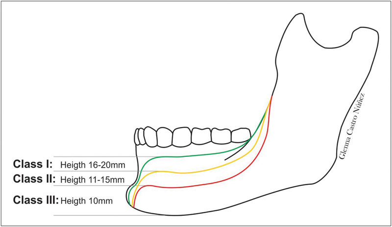 Fig. 11