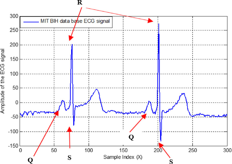 Fig. 18