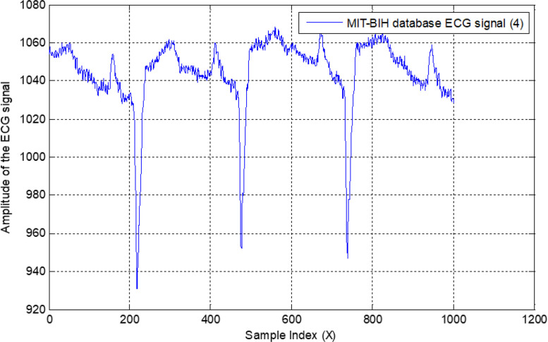 Fig. 34