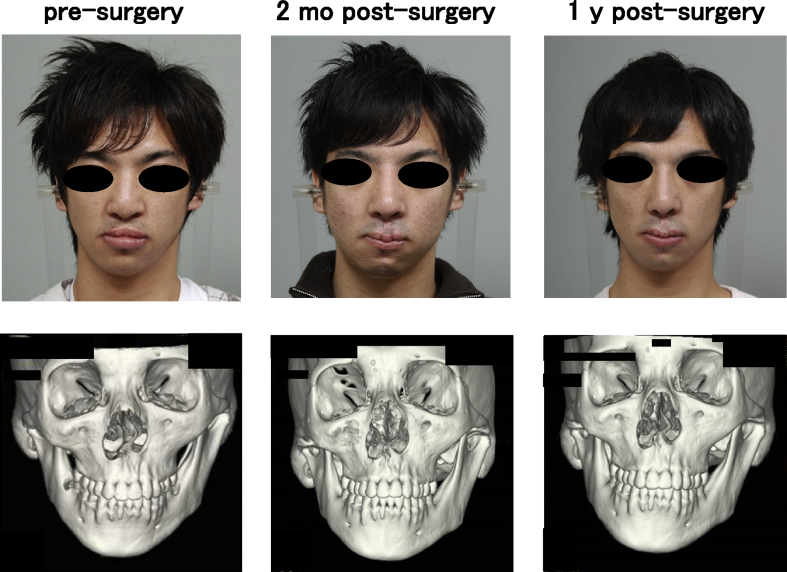 Fig. 3