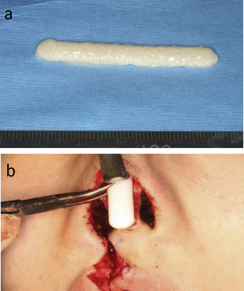 Fig. 1