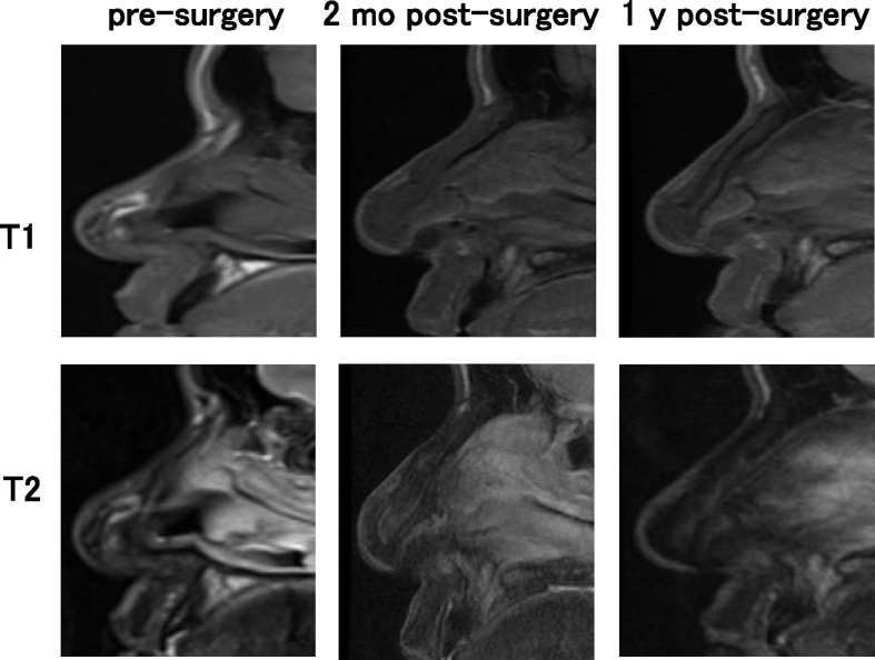 Fig. 10