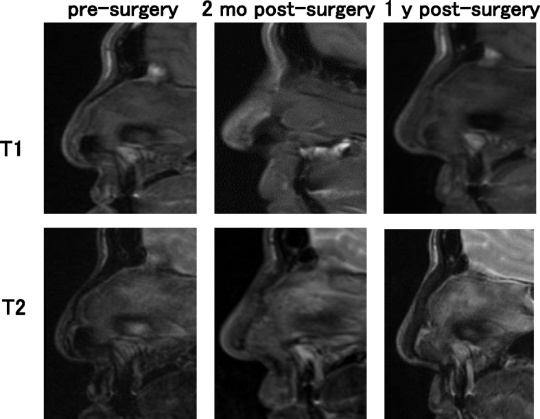 Fig. 9