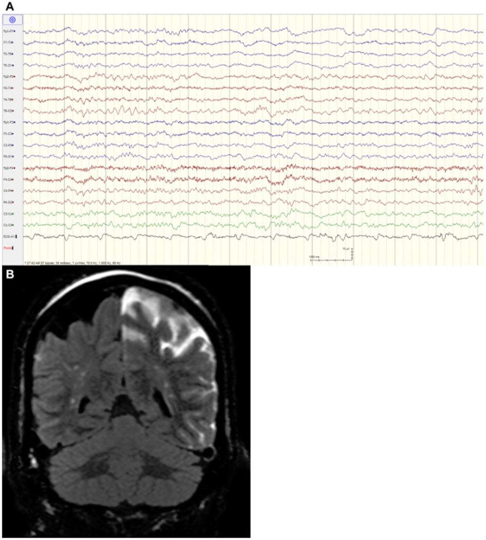 Figure 2: