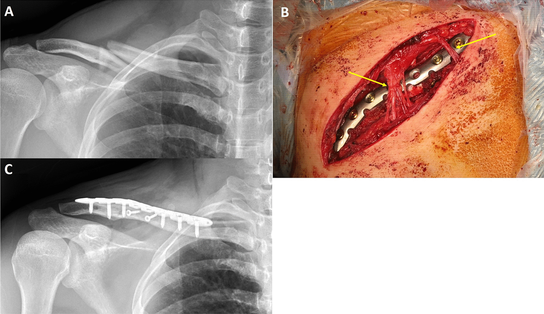 Fig.1