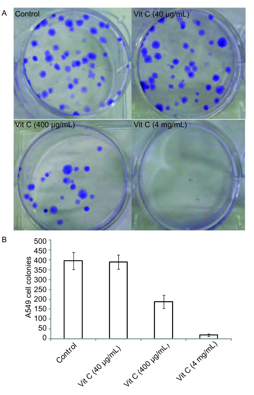 Vit C(400 μg/mL)组、Vit C(4 mg/mL)与对照组及Vit C(40 μg/ mL)组比明显抑制A549集落形成(<italic>P</italic> < 0.05)。 Compared with control group and Vit C group, Vit C (400 μg/mL) group and Vit C (4 mg/mL) group inhibited A549 colonies (<italic>P</italic> < 0.05).