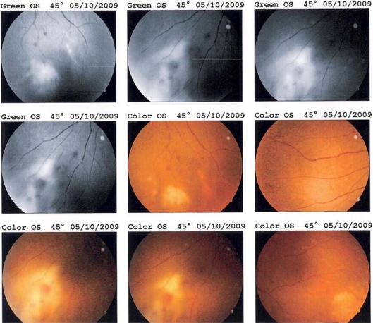 Fig. 2