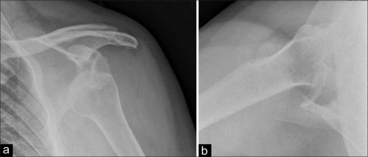 Figure 1(a,b)