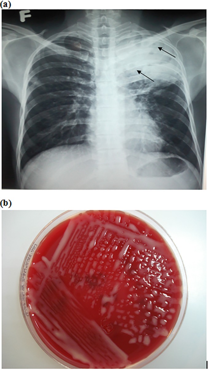 FIG 1