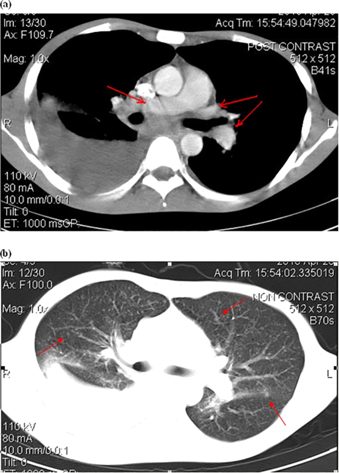 FIG 2