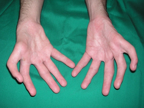 Fig. 2