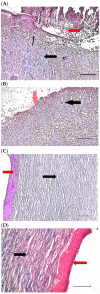 Figure 11