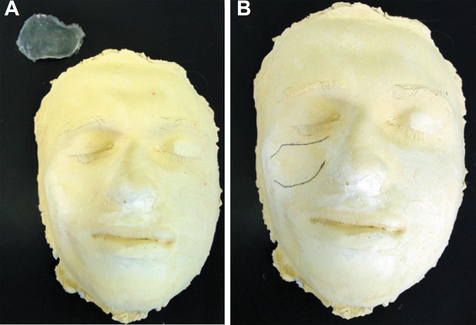 Figure 2A-B