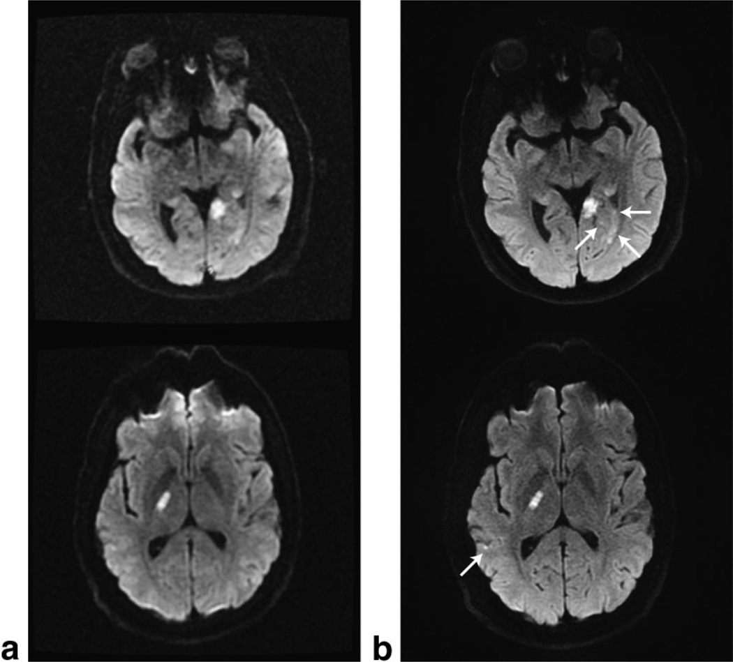 FIG. 6