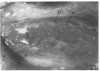81