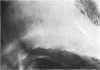 82