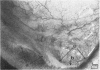 84