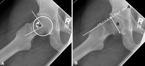 Fig. 1A–B