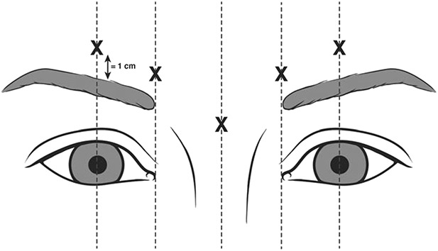 Figure 2.