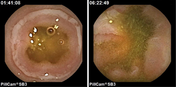 Figure 2.